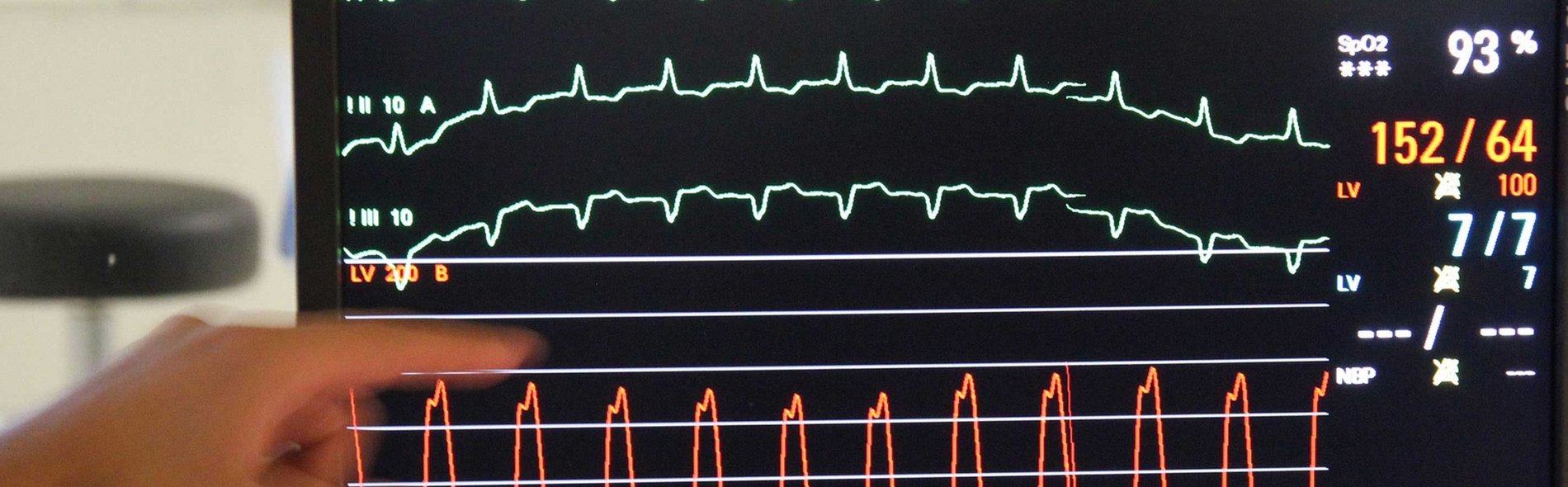 Patientenmonitor - Kardiologie