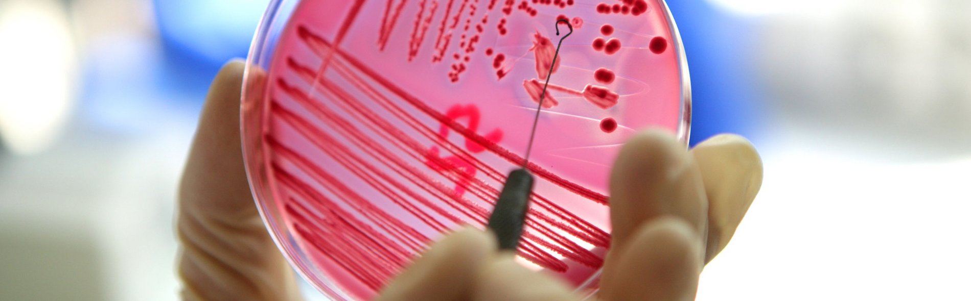 Hand, die eine Petrischale mit rotem Agar hält, der mit Bakterien durchzogen ist. Mit einer Schleifenzange wird eine Probe entnommen, was einen wissenschaftlichen, experimentellen Eindruck vermittelt.