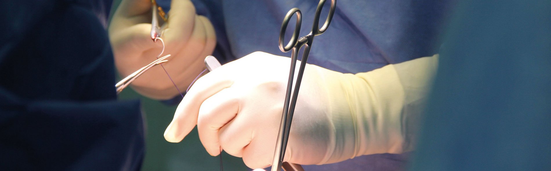 Arzthände bei einer Operation