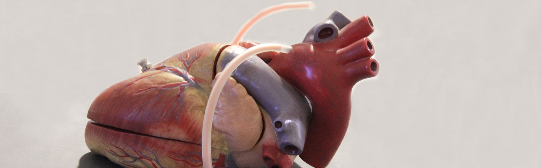 Kardiologie Herz