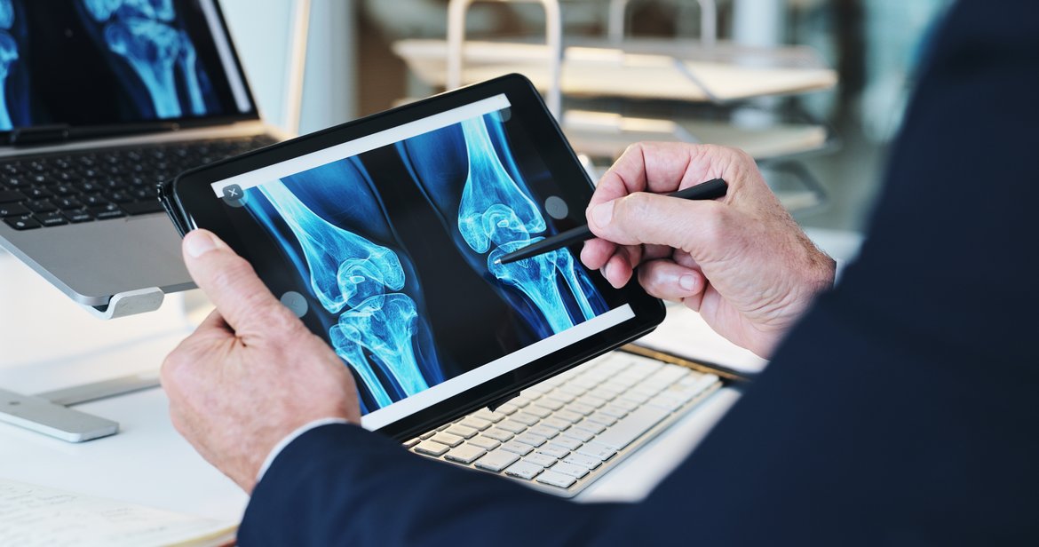 Headerbild_Endoprothetik_Knie